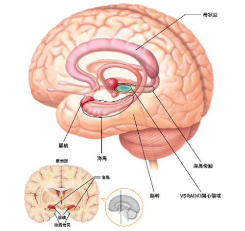 海馬との関係を立体的にとらえる